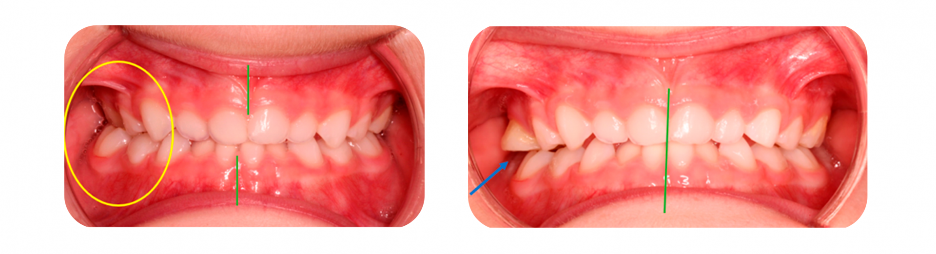 Rehabilitación neurooclusal Clínica Bucodental